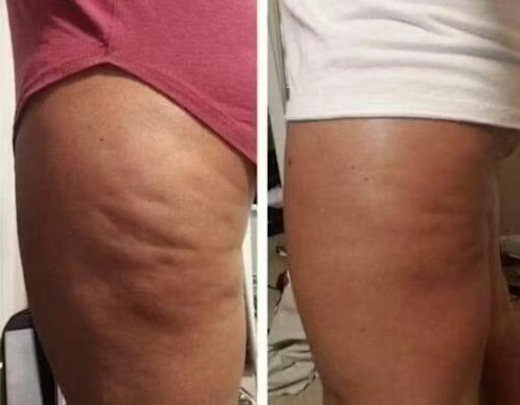 Alina S. transformation