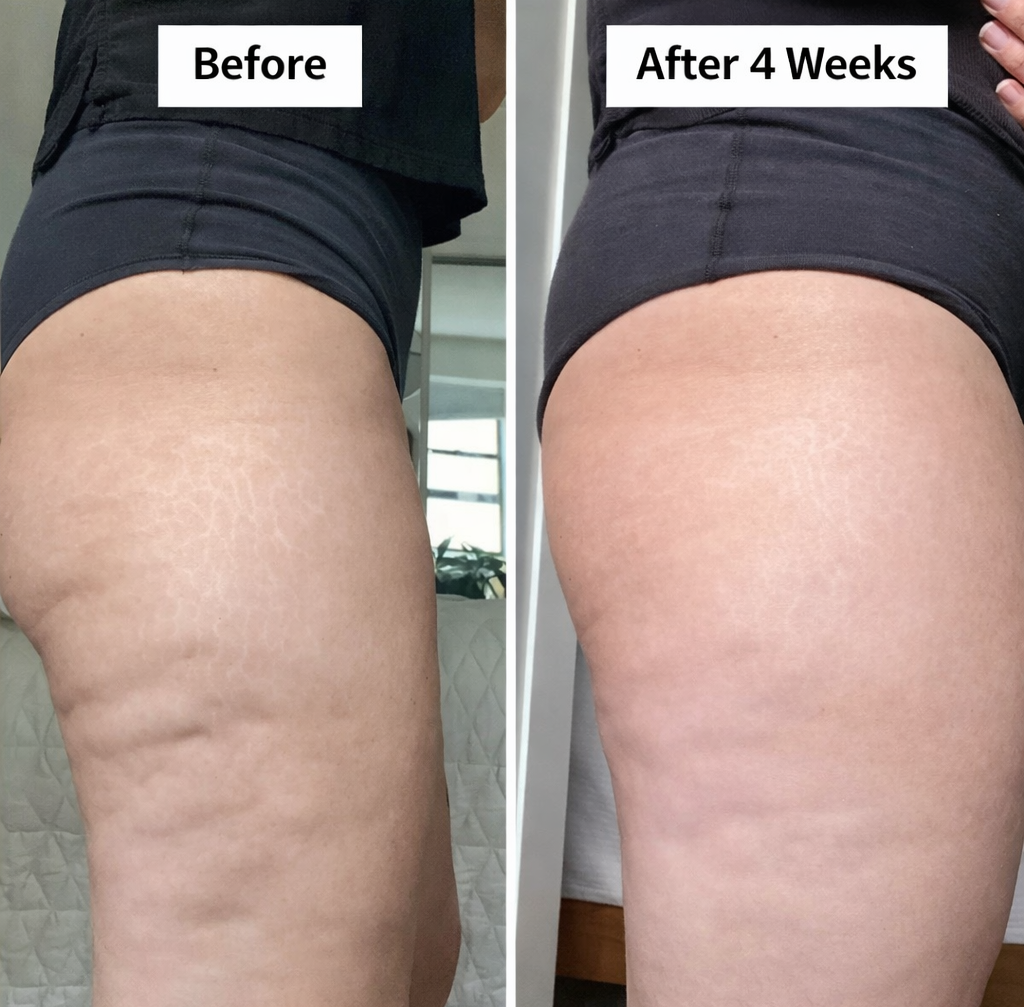 Renata D. transformation